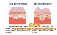 孕妇能不能用自制鱼胶原蛋白面膜（适合孕妇用的自制面膜）