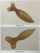 花胶补肾阴虚 花胶能补肾阳虚吗