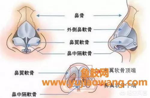 鼻翼肥厚 鼻翼肥厚3D手术视频