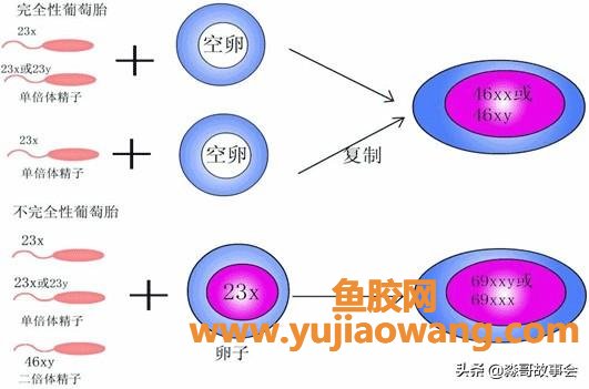 葡萄胎是怎么回事 女人怀葡萄胎是怎么回事