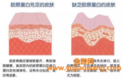 花胶与银耳哪个补胶原蛋白好 花胶与银耳哪个补胶原蛋白好一点