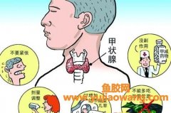 甲状腺可以吃花胶吗 甲状腺可以吃花胶吗女性